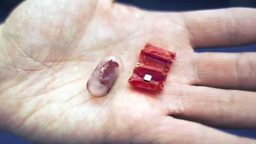 Foldable Droid Could Mend Stomachs