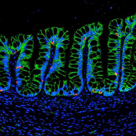 Synthetic Hydrogels Deliver Cells to Repair Intestinal Injuries